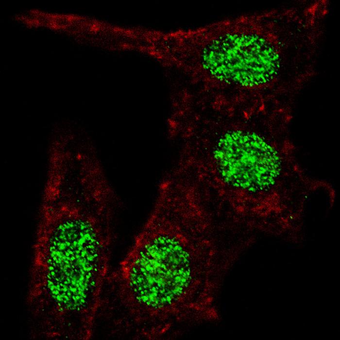 Fluorescent confocal image of HeLa cells stained KLF4 (S457) antibody. HeLa cells were fixed with 4% PFA (20 min), permeabilized with Triton X-100 (0.2%, 30 min), then incubated KLF4 (S457) primary antibody (1:100, 2 h at room temperature). For secondary antibody, Alexa Fluor 488 conjugated donkey anti-rabbit antibody (green) was used (1:1000, 1h). Cytoplasmic actin was counterstained with Alexa Fluor 555 (red) conjugated Phalloidin (5.25 mu M, 25 min). Note the highly specific localization of the phosphorylated KLF4 immunoreactivity to the nuclei but not the cytoplasm.