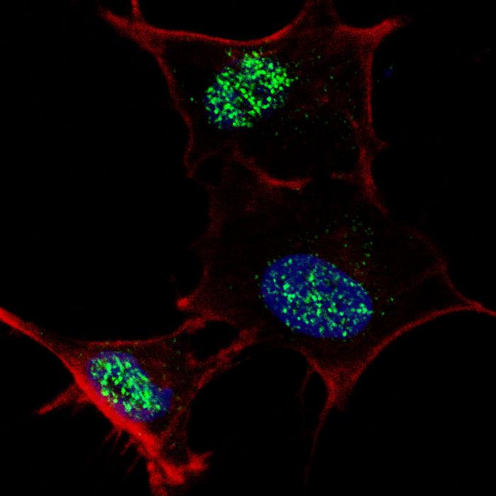 Fluorescent confocal image of SY5Y cells stained KLF4 (S457) antibody. SY5Y cells were fixed with 4% PFA (20 min), permeabilized with Triton X-100 (0.2%, 30 min), then incubated KLF4 (S457) primary antibody (1:100, 2 h at room temperature). For secondary antibody, Alexa Fluor 488 conjugated donkey anti-rabbit antibody (green) was used (1:1000, 1h). Cytoplasmic actin was counterstained with Alexa Fluor 555 (red) conjugated Phalloidin (5.25 mu M, 25 min). Note the highly specific localization of the phosphorylated KLF4 immunoreactivity to the nuclei.