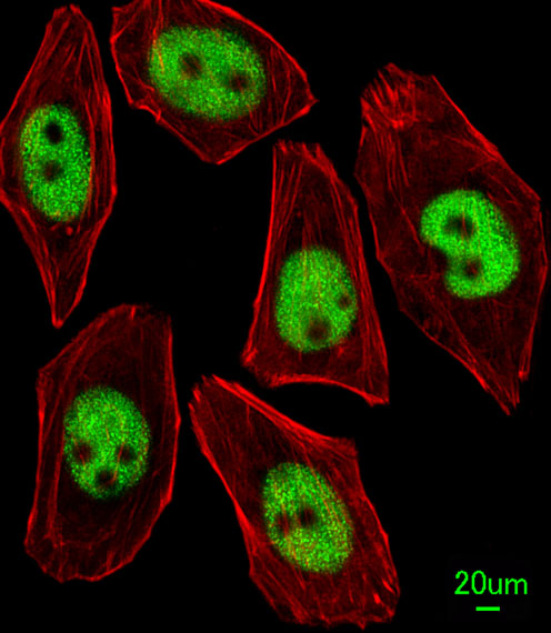 Immunofluorescent of U251 cells, using KLF4 Antibody. Antibody was diluted at 1:25 dilution. Alexa Fluor 488-conjugated goat anti-rabbit lgG at 1:400 dilution was used as the secondary antibody (green). Cytoplasmic actin was counterstained with Dylight Fluor 554 (red) conjugated Phalloidin (red).