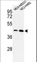 Western blot of KLF4-S457 in MDA-MB231, NCI-H460 cell line lysates (35 ug/lane). KLF4 (arrow) was detected using the purified antibody.