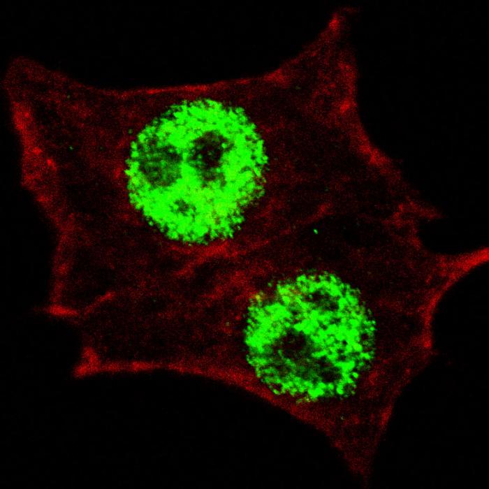 Fluorescent confocal image of HeLa cells stained Phospho-KLF4-S245 antibody. HeLa cells were fixed with 4% PFA (20 min), permeabilized with Triton X-100 (0.2%, 30 min), then incubated Phospho-KLF4-S245 primary antibody (1:200, 2 h at room temperature). For secondary antibody, Alexa Fluor 488 conjugated donkey anti-rabbit antibody (green) was used (1:1000, 1h). Cytoplasmic actin was counterstained with Alexa Fluor 555 (red) conjugated Phalloidin (5.25 mu M, 25 min). Note the highly specific localization of the phosphorylated KLF4 immunoreactivity to the nuclei but not the nucleoli or the cytoplasm.