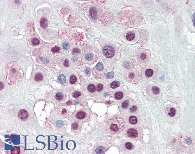 Anti-KLF5 antibody IHC of human placenta. Immunohistochemistry of formalin-fixed, paraffin-embedded tissue after heat-induced antigen retrieval. Antibody LS-B3081 concentration 5 ug/ml.