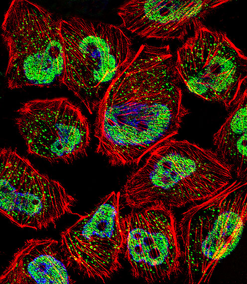 Fluorescent confocal image of U251 cell stained with KLF5 Antibody. U251 cells were fixed with 4% PFA (20 min), permeabilized with Triton X-100 (0.1%, 10 min), then incubated with KLF5 primary antibody (1:25, 1 h at 37°C). For secondary antibody, Alexa Fluor 488 conjugated donkey anti-rabbit antibody (green) was used (1:400, 50 min at 37°C). Cytoplasmic actin was counterstained with Alexa Fluor 555 (red) conjugated Phalloidin (7units/ml, 1 h at 37°C). Nuclei were counterstained with DAPI (blue) (10 ug/ml, 10 min). KLF5 immunoreactivity is localized to vesicles and Nucleus significantly.