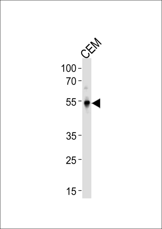 KLF5 Antibody western blot of CEM cell line lysates (35 ug/lane). The KLF5 antibody detected the KLF5 protein (arrow).