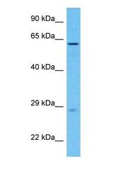 Western blot of KLF5 Antibody with human Stomach Tumor lysate.