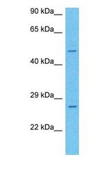 Western blot of KLF5 Antibody with human Fetal Liver lysate.
