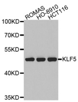 Western blot analysis of extracts of various cell lines, using KLF5 antibody. (1: ROMAS cell lysate 2: HO-8910 cell lysate 3: HCT116 cell lysate)