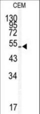 Western blot of KLF5 antibody in CEM cell line lysates (35 ug/lane). KLF5 (arrow) was detected using the purified antibody.