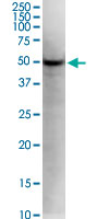 KLF5 monoclonal antibody (M01), clone 2G12. Western Blot analysis of KLF5 expression in HeLa.