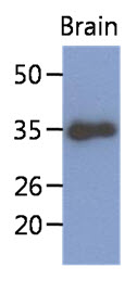 Western Blot: The extract of mouse brain (40 ug) were resolved by SDS-PAGE, transferred to PVDF membrane and probed with anti-human KLF7 antibody (1:1000). Proteins were visualized using a goat anti-mouse secondary antibody conjugated to HRP and an ECL detection system.