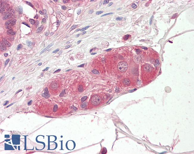 Anti-KLF8 antibody IHC staining of human small intestine, submucosal plexus. Immunohistochemistry of formalin-fixed, paraffin-embedded tissue after heat-induced antigen retrieval.