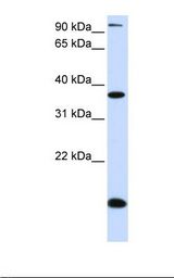 Placenta lysate. Antibody concentration: 1.0 ug/ml. Gel concentration: 12%.