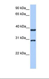 Hela cell lysate. Antibody concentration: 1.0 ug/ml. Gel concentration: 12%.
