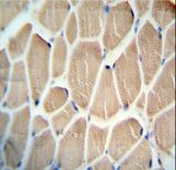 KLHDC1 antibody immunohistochemistry of formalin-fixed and paraffin-embedded human skeletal muscle followed by peroxidase-conjugated secondary antibody and DAB staining.