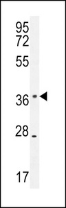 KLHDC1 Antibody western blot of mouse spleen tissue lysates (35 ug/lane). The KLHDC1 antibody detected the KLHDC1 protein (arrow).