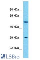 KLHDC10 antibody Western Blot of Breast Tumor. Antibody dilution: 1 ug/ml.