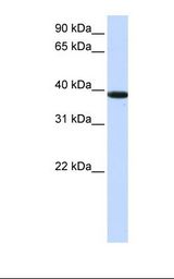 Jurkat cell lysate. Antibody concentration: 1.0 ug/ml. Gel concentration: 12%.