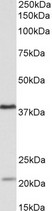 KLHDC8B antibody (0.5 ug/ml) staining of Daudi lysate (35 ug protein in RIPA buffer). Primary incubation was 1 hour. Detected by chemiluminescence.