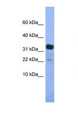 KLHDC9 antibody LS-C145228 Western blot of Mouse Pancreas lysate. Antibody concentration 1 ug/ml.