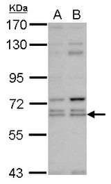 Sample (30 ug of whole cell lysate) A: NT2D1 B: IMR32 7.5% SDS PAGE C3IP1 antibody diluted at 1:1000