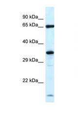 KLHL12 antibody LS-C145444 Western blot of Rat Brain lysate. Antibody concentration 1 ug/ml.