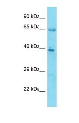 Western blot of Human Stomach Tumor. KLHL12 antibody dilution 1.0 ug/ml.