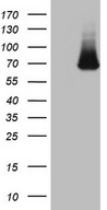 HEK293T cells were transfected with the pCMV6-ENTRY control (Left lane) or pCMV6-ENTRY KLHL12 (Right lane) cDNA for 48 hrs and lysed. Equivalent amounts of cell lysates (5 ug per lane) were separated by SDS-PAGE and immunoblotted with anti-KLHL12.