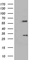 HEK293T cells were transfected with the pCMV6-ENTRY control (Left lane) or pCMV6-ENTRY KLHL12 (Right lane) cDNA for 48 hrs and lysed. Equivalent amounts of cell lysates (5 ug per lane) were separated by SDS-PAGE and immunoblotted with anti-KLHL12.