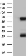 HEK293T cells were transfected with the pCMV6-ENTRY control (Left lane) or pCMV6-ENTRY KLHL12 (Right lane) cDNA for 48 hrs and lysed. Equivalent amounts of cell lysates (5 ug per lane) were separated by SDS-PAGE and immunoblotted with anti-KLHL12.