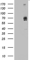 HEK293T cells were transfected with the pCMV6-ENTRY control (Left lane) or pCMV6-ENTRY KLHL12 (Right lane) cDNA for 48 hrs and lysed. Equivalent amounts of cell lysates (5 ug per lane) were separated by SDS-PAGE and immunoblotted with anti-KLHL12.