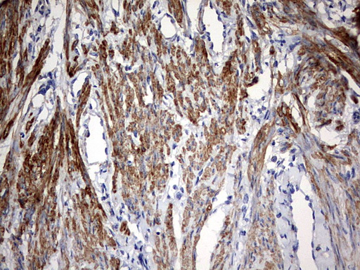 IHC of paraffin-embedded Human endometrium tissue using anti-KLHL12 mouse monoclonal antibody. (Heat-induced epitope retrieval by 10mM citric buffer, pH6.0, 120°C for 3min).