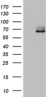 HEK293T cells were transfected with the pCMV6-ENTRY control (Left lane) or pCMV6-ENTRY KLHL12 (Right lane) cDNA for 48 hrs and lysed. Equivalent amounts of cell lysates (5 ug per lane) were separated by SDS-PAGE and immunoblotted with anti-KLHL12.