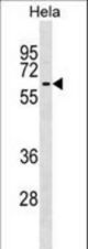 KLHL12 Antibody western blot of HeLa cell line lysates (35 ug/lane). The KLHL12 antibody detected the KLHL12 protein (arrow).