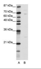A: Marker, B: Jurkat Cell Lysate