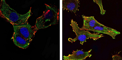 Immunofluorescence of NTERA-2 cells (left) and U251 (right) cells using KLHL13 mouse monoclonal antibody (green). Blue: DRAQ5 fluorescent DNA dye. Red: Actin filaments have been labeled with Alexa Fluor-555 phalloidin.
