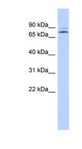 KLHL14 antibody LS-C111318 Western blot of Fetal Kidney lysate.