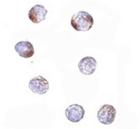 Immunocytochemistry of KLHL15 in HeLa cells with KLHL15 antibody at 5 ug/ml.