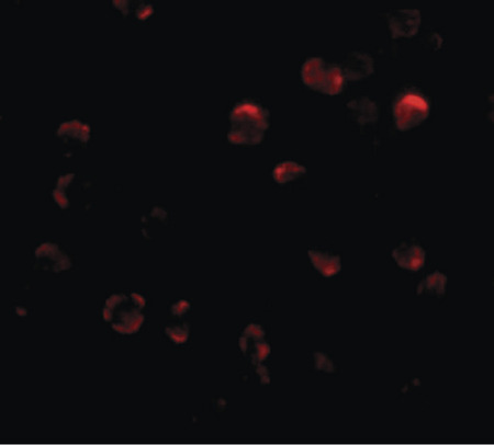Immunofluorescence of KLHL15 in HeLa cells with KLHL15 antibody at 20 ug/ml.