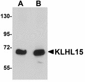 Western blot of KLHL15 in HeLa cell lysate with KLHL15 antibody at (A) 1 and (B) 2 ug/ml.