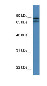 KLHL22 antibody LS-C135849 Western blot of Jurkat lysate.