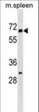 KLH22 Antibody western blot of mouse spleen tissue lysates (35 ug/lane). The KLH22 antibody detected the KLH22 protein (arrow).