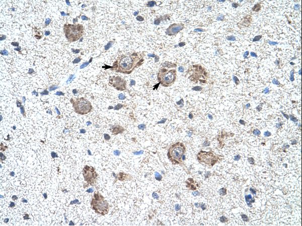 KLHL25 antibody LS-C31795 was used in IHC to stain formalin-fixed, paraffin-embedded human brain.