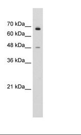 Jurkat Cell Lysate