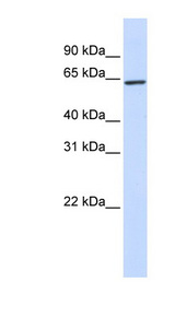 KLHL25 antibody LS-C109975 Western blot of Transfected 293T cell lysate.