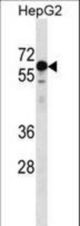 KLHL25 Antibody western blot of HepG2 cell line lysates (35 ug/lane). The KLHL25 antibody detected the KLHL25 protein (arrow).