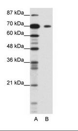 A: Marker, B: Jurkat Cell Lysate