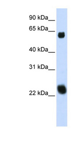 KLHL26 antibody LS-C109933 Western blot of 293T cell lysate.