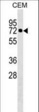 KLHL28 Antibody western blot of CEM cell line lysates (35 ug/lane). The KLHL28 Antibody detected the KLHL28 protein (arrow).