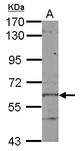 Sample (50 ug of whole cell lysate) A: mouse liver 7.5% SDS PAGE KLHL28 / BTBD5 antibody diluted at 1:1000
