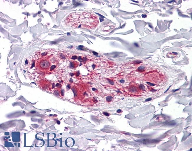 Anti-KLHL3 antibody IHC of human colon. Immunohistochemistry of formalin-fixed, paraffin-embedded tissue after heat-induced antigen retrieval. Antibody LS-B5609 concentration 5 ug/ml.
